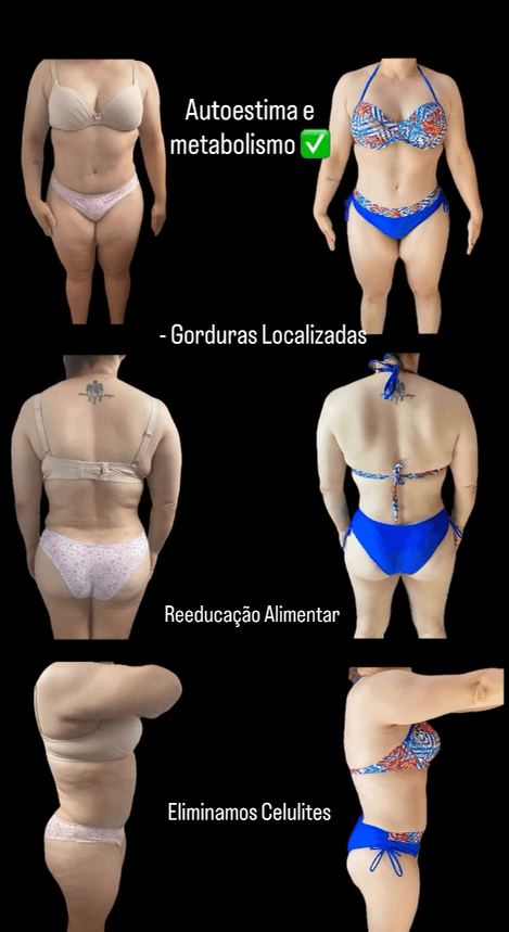 Comparativo de evolução corporal compartilhado por paciente