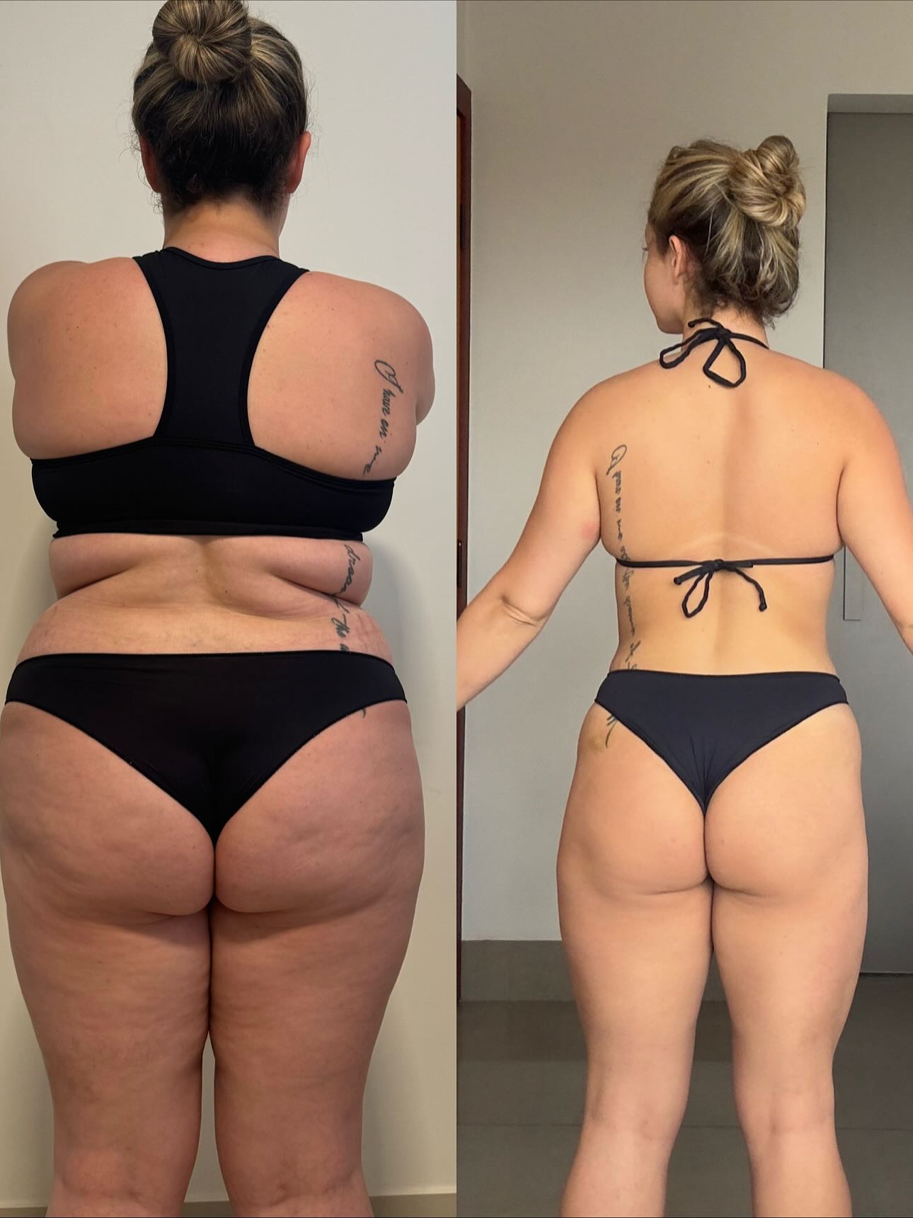 Registro autorizado de evolução corporal em vista posterior
